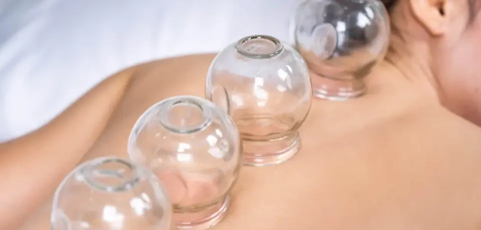 cupping-therapy-scaled-1_sd