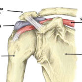 subacromial-bursitis500