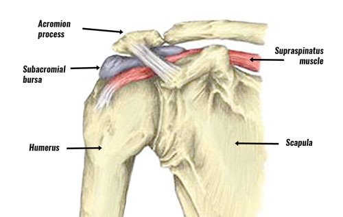 subacromial-bursitis500