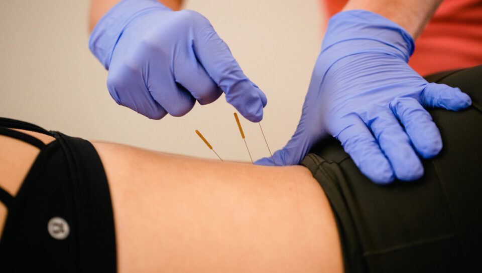 Dry-Needling-back-1920x1280 Dry-Needling-back-1920x1280