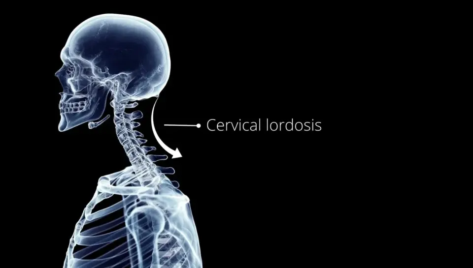 cervical_lordosis-stjosephsphysio.com cervical_lordosis-stjosephsphysio.com