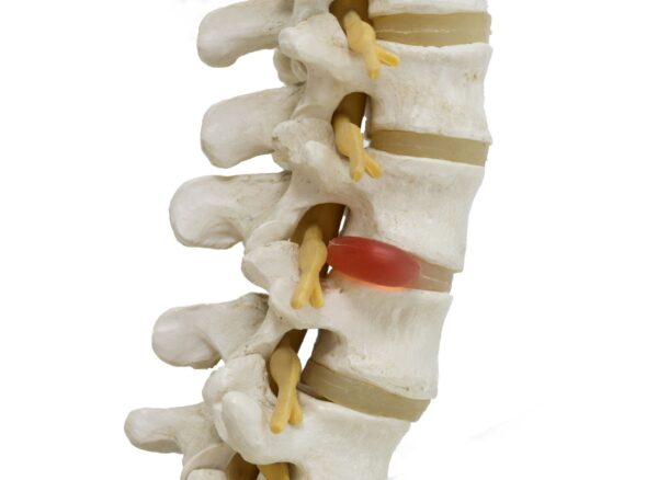 GettyImages-864323518-180af046d5c14d5092ca84a16abed372 GettyImages-864323518-180af046d5c14d5092ca84a16abed372