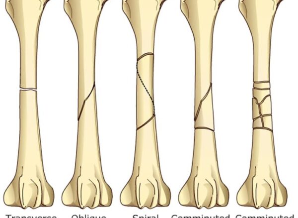 frac-class-768x690 frac-class-768x690