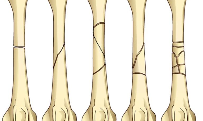 frac-class-768x690 frac-class-768x690