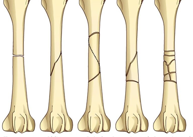 frac-class-768x690 frac-class-768x690