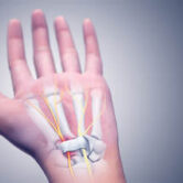 sindroma-e-tunelit-karpal sindroma-e-tunelit-karpal