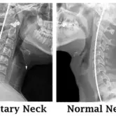 3762-Military_Neck_642x361 (1) 3762-Military_Neck_642x361 (1)