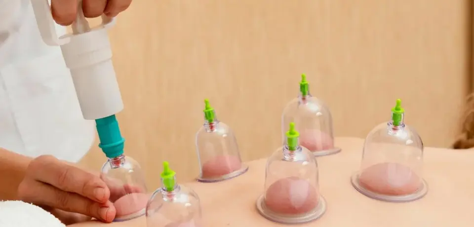 vacuum-cupping-set-6-pcs-kit-pull-out-a-vacuum-apparatus-therapy-6614a-1000x1000